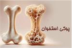 راههای مقابله با «پوکی استخوان» در هفته ملی سلامت استخوان