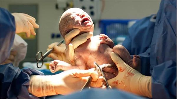 Unnecessary Cesarean Deliveries Threaten Mother and Baby’s Health